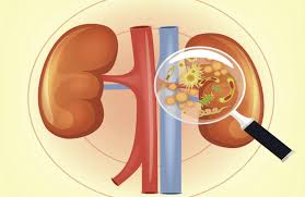 Contrast that to the feeling of. 13 Signs And Symptoms You Might Have A Kidney Infection Slideshow The Active Times