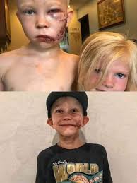 A 3-year-old boy's brave dash into the dark to save his great-grandma is  inspiring his whole family to live with less fear, and reminding all of us  what courage really looks like.