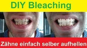 Bestelle aus einem der am besten aufeinander abgestimmten home bleaching systeme, damit zähne aufhellen zu hause leicht selbst ausgeführt werden kann. Zahne Zu Hause Selber Bleichen Diy Bleaching Zahne Aufhellen Mit Backpulver Youtube