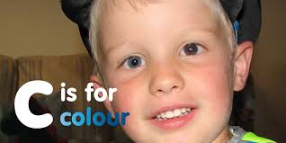 The child may present with squinting or a white mass seen through the lens of the eye. Chect Uk On Twitter It S National Eye Health Week Retinoblastoma Rb Is A Rare Form Of Eye Cancer That Affects Babies Young Children Spot The Signs Ispyrb Https T Co Pnkraym5ni