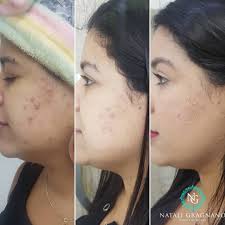 Natali Gragnano Estética Avançada