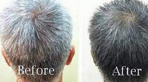 Sometimes, it may also be genetic. Onion Juice It Turns Gray Hair Back To Its Natural Color Youtube