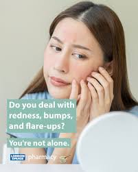 Dealing with Rosacea? There are many Canadians that struggle with this. Our  pharmacists are here to help you. Visit your local London Drugs Pharmacy to  learn more. #Rosacea #LondonDrugsPharmacy