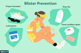 How To Prevent Blisters On Feet: 8 Tips To Keep In Mind