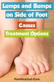 Pin On Foot Care Ideas