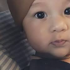 What causes white patches