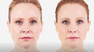 Dr. Bohley Reviews Portland OR