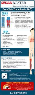Dvt And Boating 8 Simple Ways To Minimize Your Risk Dan Boater