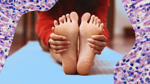 When foot melanoma is diagnosed during its early stages, the cancer is easier to treat. Why Does Acral Lentiginous Melanoma Impact Dark Skin More Allure