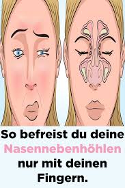 Nasennebenhöhlen, welche als resonanzräume dienen. 21 Nase Ideen Nase Nasennebenhohlen Gesundheit