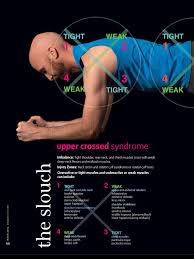 Upper Crossed Syndrome Upper Cross Syndrome Exercises Upper Cross Syndrome Tight Muscles