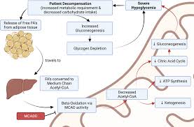 Image result for MCAD Deficiency