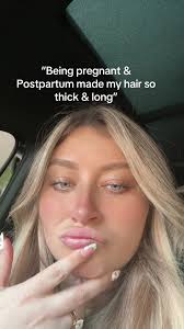 Postpartum Hair Changes: Embracing Baby Hairs