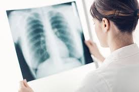 Die copd (chronic obstructive pulmonary disease) ist eine chronisch fortschreitende erkrankung der lunge. Copd Anzeichen Ursachen Therapie Reha