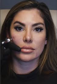 Eustache institute keeping my skin right & tight ❤️‍🔥🔥 #morpheus8 #...