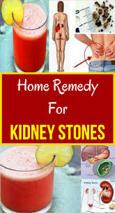 Home Remedy For Kidney Stones Remedies Kidney Stones Remedy Home Remedies