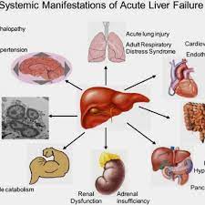 Pin On My Liver Hurts