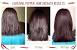 Finasteride Before And After