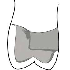 The black rectangle around the rim piece on the. Coping Design For A Metal Ceramic Restoration With A Buccal Cusp In Download Scientific Diagram