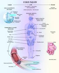 Image result for Cold Weather Injury