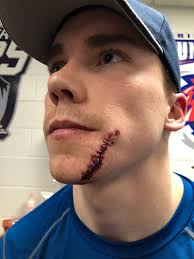 Michael Rioux (@keeper_31)