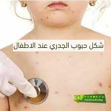 شكل حبوب الجدري عند الاطفال hand soap bottle person soap bottle