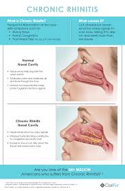 Nasal administration, a method of pharmaceutical drug delivery. Runny Nose Post Nasal Drip Treatment David C Brodner Md