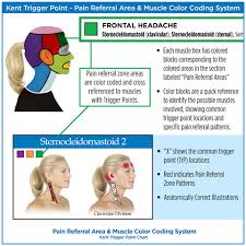 myofascial trigger point charts