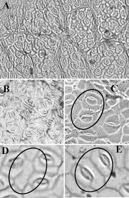4.6 out of 5 stars. Microscopic View Of The Adaxial Surface Of Groundnut Leaf A General Download Scientific Diagram