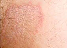 Pin On Home Remedies