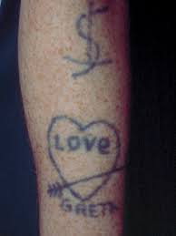 Tattoo removal johnson city tn. Techniques And Devices Used For Tattoo Removal Springerlink