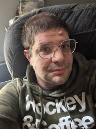 Hi everyone I'm Joshua From NJ with NF1