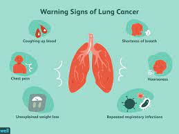What is the first symptom of lung cancer. Is My Cough A Lung Cancer Cough