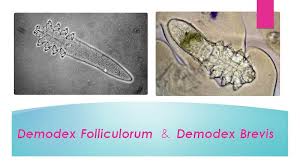 Image result for Demodex brevis