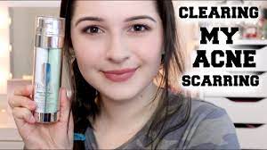 4.5/5 stars from 23 reviews. Clinique Dark Spot Corrector For Acne Scars Youtube