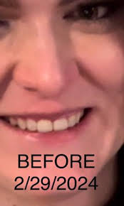 Ascend Dental, 1001 N Washington St, Naperville, IL 60563, US