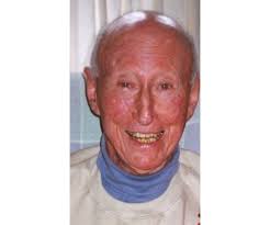 DOUGLAS FISHER Obituary (1925