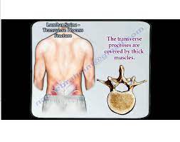 Lumbar Spine Transverse Process Fracture Orthopaedicprinciples Com