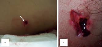 The decedent was essentially executed during a robbery. Ballistics Chapter 10 Color Atlas Of Emergency Trauma