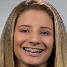 Alana smith (born october 20, 2000) is a professional american skateboarder from mesa, arizona. Alana Smith Bio Family Trivia Famous Birthdays
