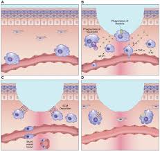 Check spelling or type a new query. Wound Healing A Cellular Perspective Physiological Reviews