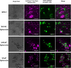 Targeting Prostate Cancer Stem Like Cells By An Immunotherapeutic Platform Based On Immunogenic Peptide Sensitized Dendritic Cells Cytokine Induced Killer Cells Stem Cell Research Therapy Full Text