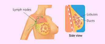 If breast cancer comes back regionally, it means that the cancer has returned to the lymph nodes or near to the original cancer but not exactly the same place. How Can Breast Cancer Be Detected Symptoms Treatment