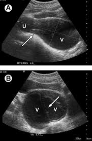 Check spelling or type a new query. Ultrasound Of The Pediatric Female Pelvis Sciencedirect