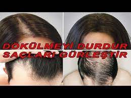 dokulen ve seyrek saci gurlestiren sac kokunu canlandiran sarimsak kuru 100 cozum guzellik bakim youtube sac guzellik saglikli sac