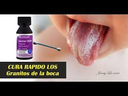 Remedio Que Quita Los Granos De La Boca En Un Dia Youtube Remedios Para Granos Como Quitar Granos Bocas