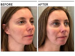 The 14 Best Anti-Aging Creams of 2024, Tested and Expert-Backed