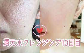 毛穴から角栓がにゅるっと流れ出る あの仲里依紗も効果を実感の毛穴ケアで素肌美人 毛穴 角栓 毛穴 クレンジング