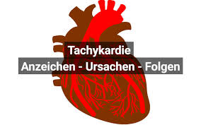 Tachykardie Herzrasen Ursachen Und Therapie Praktischarzt