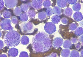 Image result for mastocytoma in dogs